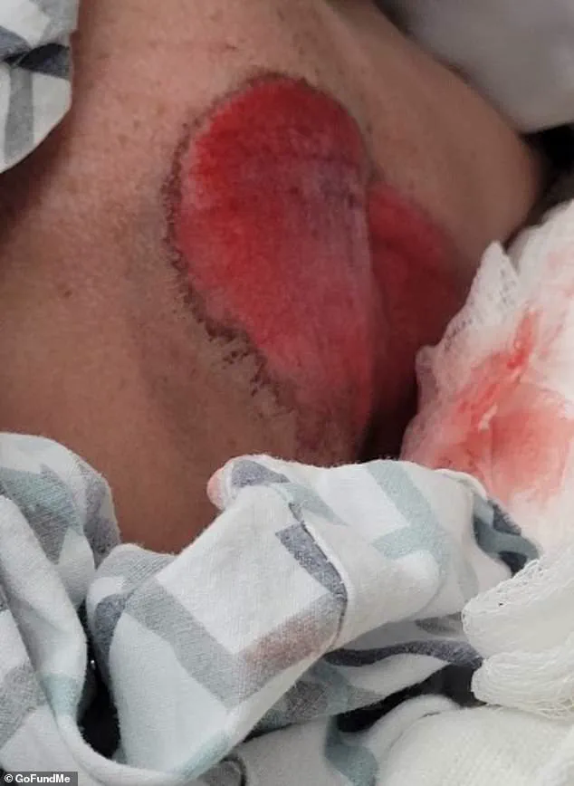 Near-Fatal School Zone Accident Prompts Calls for Enhanced Safety Regulations in Wisconsin