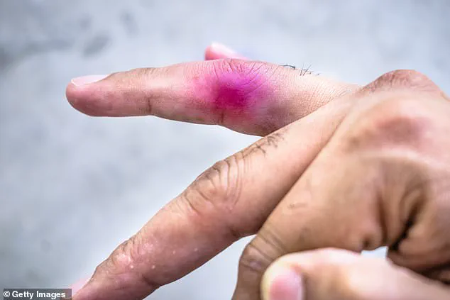 Nine-Year-Old Sues 11-Year-Old Peer After Toy Dinosaur Incident Nearly Severes Finger in Rare Legal Case