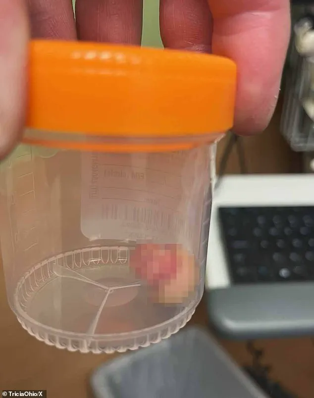 Violent Clash in Minneapolis Escalates: Officer Suffers Grotesque Injury After Fatal Shooting