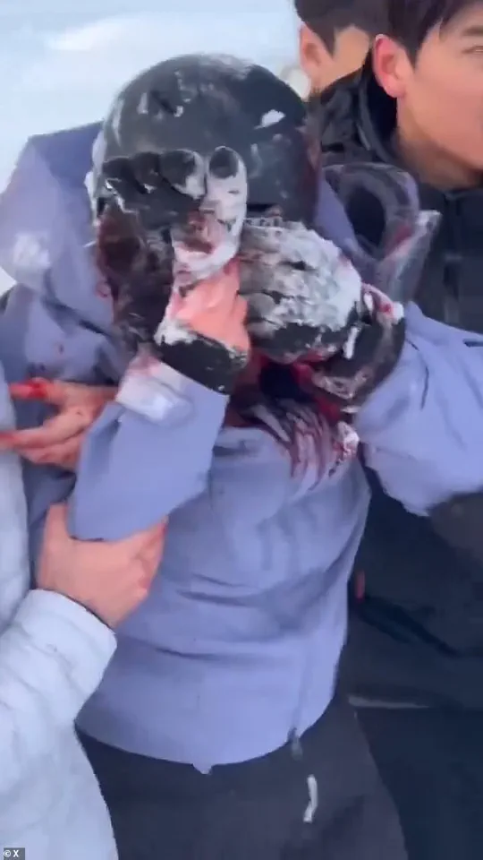 BREAKING: Rare Snow Leopard Attacks Tourist in Northern China's UNESCO Site – Chilling Selfie Taken Moments Before Brutal Encounter