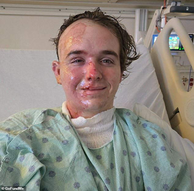 Coworker Arrested After Throwing Scalding Oil On McDonald's Manager