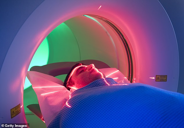 David Mallon attributes lasting brain damage and memory loss to gadolinium toxicity from MRIs.