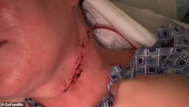 Doctors Missed Cancer Symptoms in Nurse Who Sought Multiple Biopsies